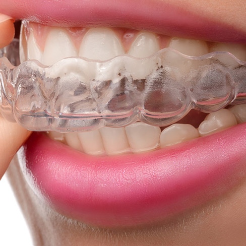 Foto 3 de Eloir Feijó Jr. - Implantodontia e Ortodontia