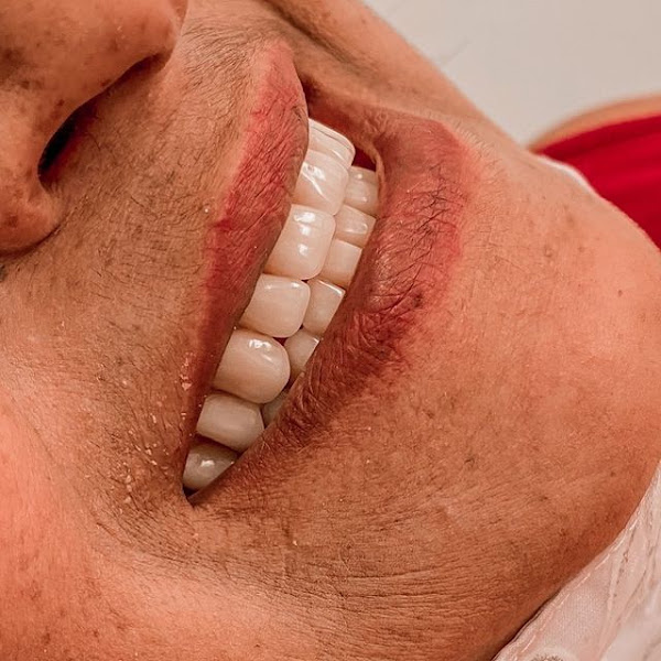 Foto 2 de Elos Odontologia - Gengivoplastia em Suzano - Prótese Dental em Suzano - Reabilitação Oral em Suzano