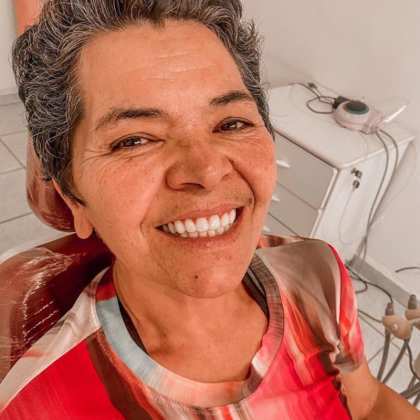 Foto 3 de Elos Odontologia - Gengivoplastia em Suzano - Prótese Dental em Suzano - Reabilitação Oral em Suzano