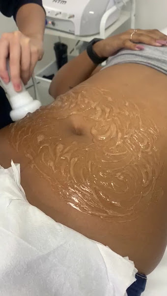 Foto 3 de Emagrecentro Barra Funda