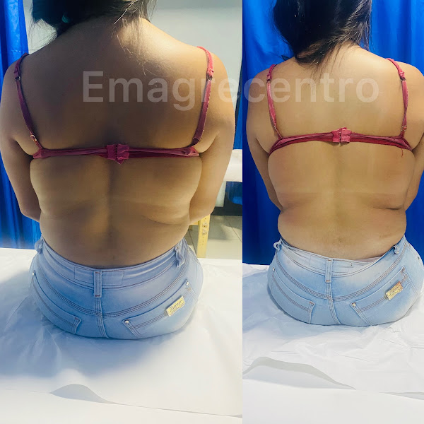 Foto 2 de Emagrecentro Lagarto