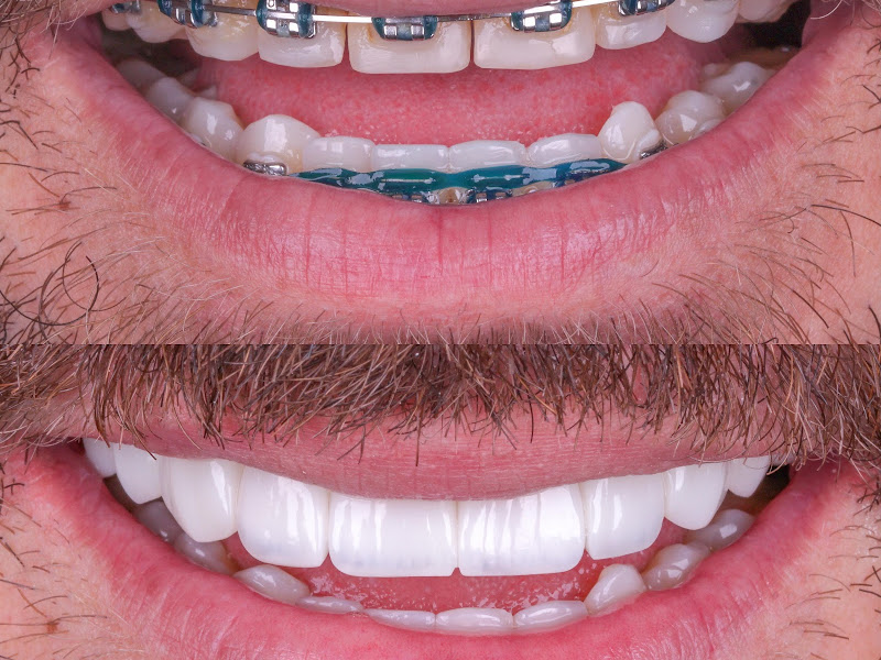 Foto 3 de Emerson Finholdt, Dentista