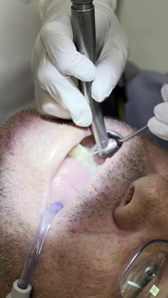 Foto 4 de Encanttá Odontologia | Implante Dentário | Dentista | Alto | Piracicaba - SP