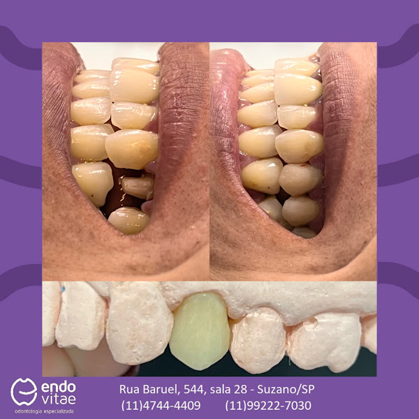 Foto 3 de Endo Vitae Odontologia Especializada