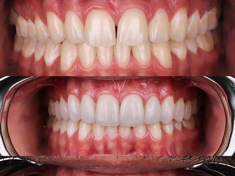 Foto 3 de Endodontia Exclusiva Dr. Sady Oliveira