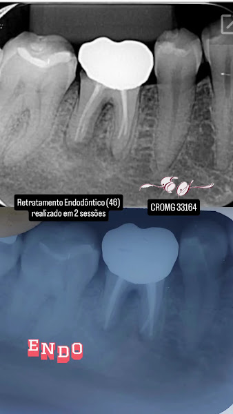 Foto 3 de Endodontista - Dra. Eriana Santos - Juiz de Fora