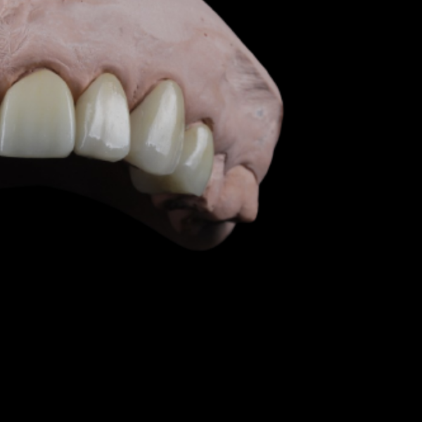 Foto 2 de Enelab´s Estética Odontológica