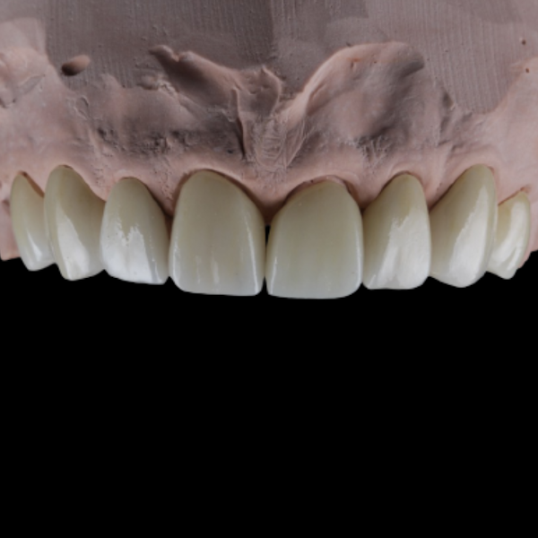 Foto 3 de Enelab´s Estética Odontológica