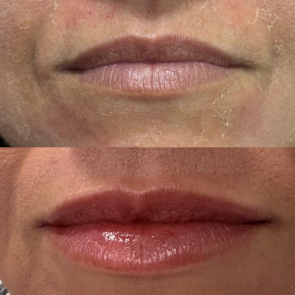 Foto 2 de EntreFaces- Odontologia