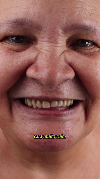 Foto 3 de EP Odontologia | Implantes Dentários em Uberaba