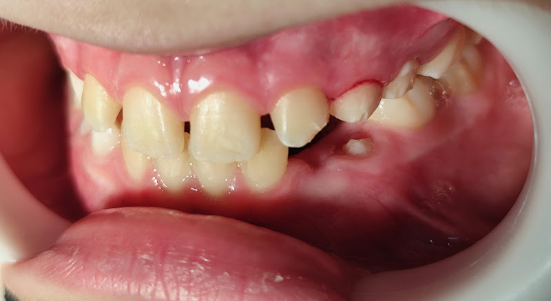 Foto 3 de Erez Odontologia