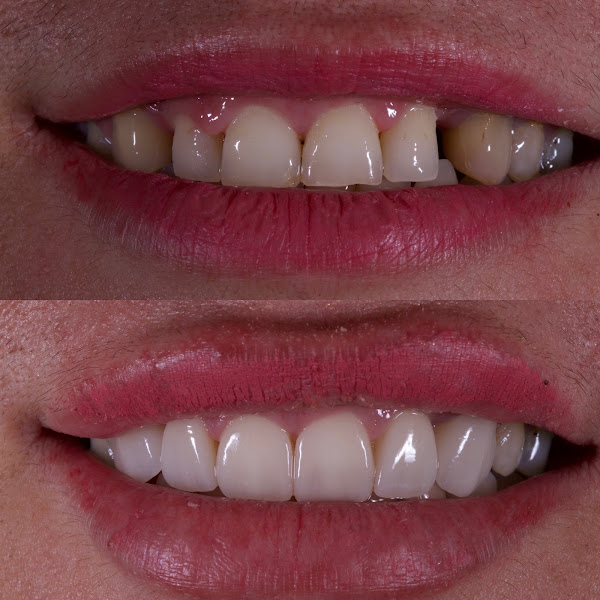 Foto 3 de Ergang Odontologia