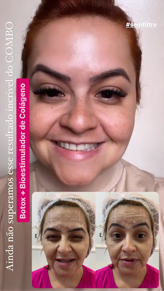 Foto 3 de Erica Nobre Estética