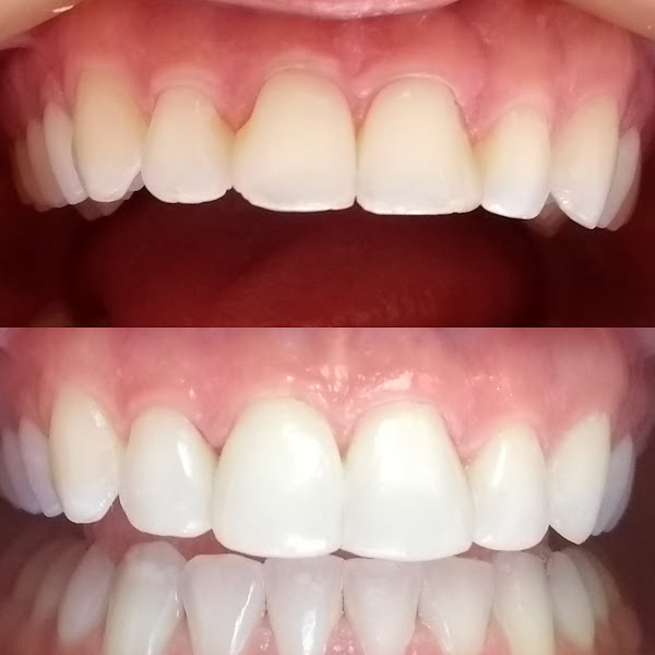 Foto 3 de Erika Perroni Odontologia Estética