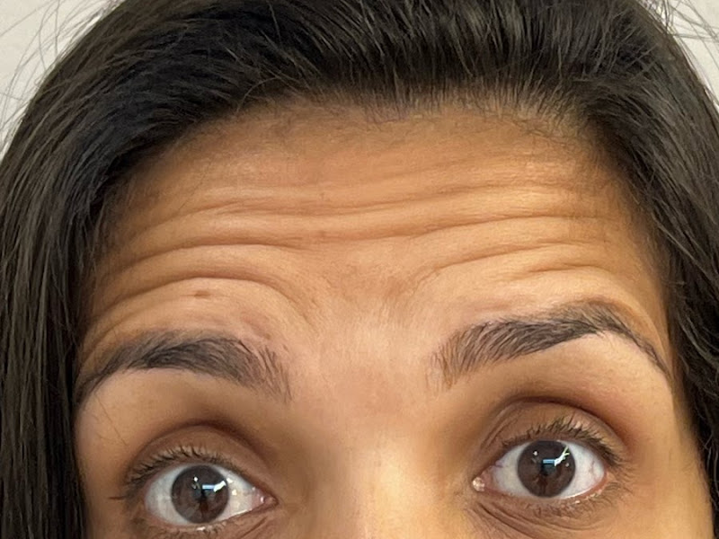 Foto 2 de Erikka Moraes I Cirurgiã-dentista - CRO-RJ 55845