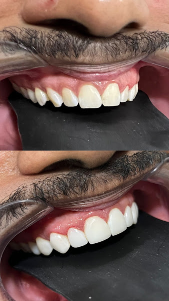 Foto 2 de ES odontologia | Unidade Lapa - São Paulo