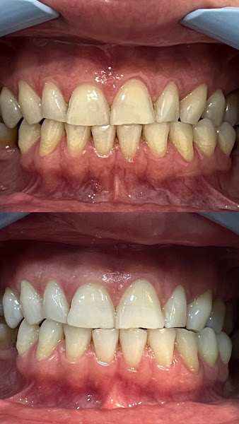 Foto 3 de ES odontologia | Unidade Lapa - São Paulo