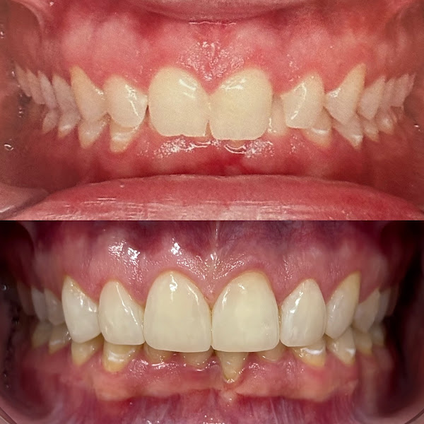 Foto 3 de Esculture Clínica Odontológica em Ipatinga