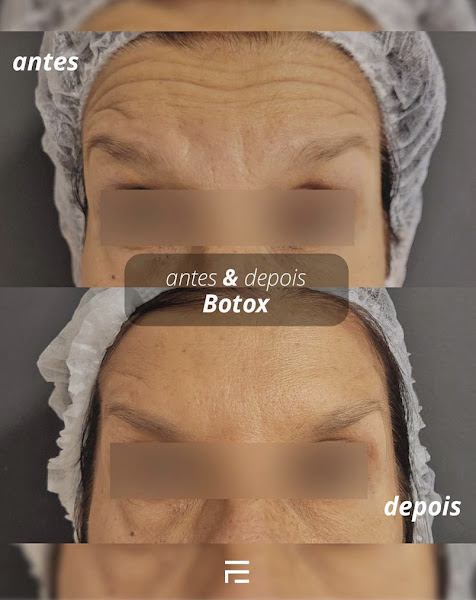 Foto 3 de Espaço Facial Botafogo - Harmonização Facial