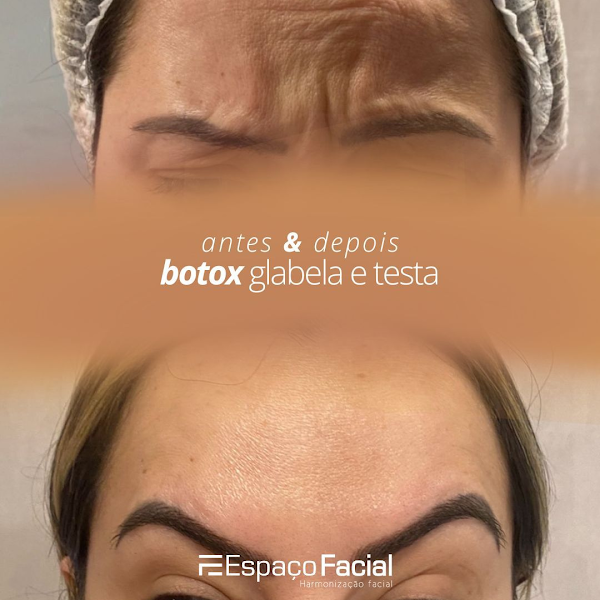 Foto 2 de Espaço Facial Recreio Shopping - Harmonização Facial