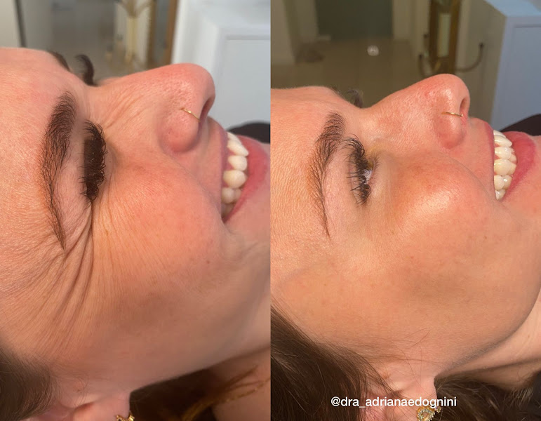 Foto 3 de Espaço Inovar Estética | Harmonização Facial em Brusque