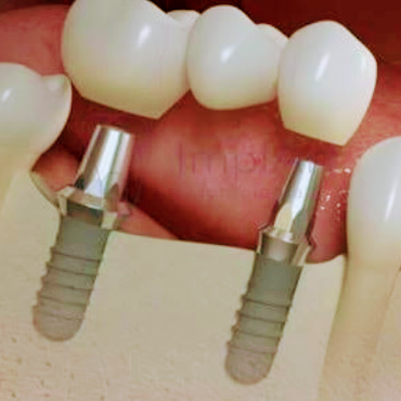 Foto 3 de Espaço Odontológico Madre, Aparecida de Goiânia