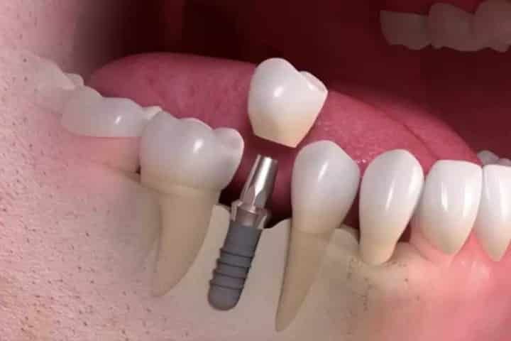 Foto 3 de Espaço Odontológico Souza Castro