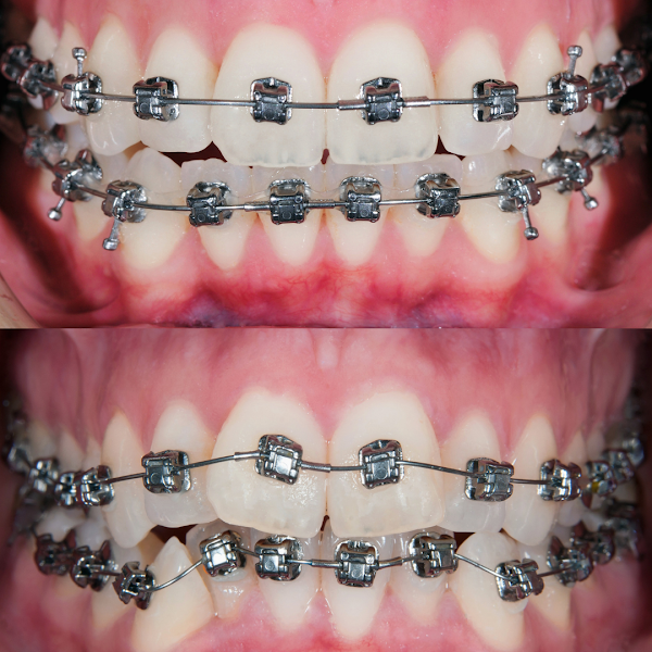 Foto 2 de EspacOrtoDental