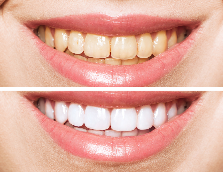 Foto 3 de EspacOrtoDental