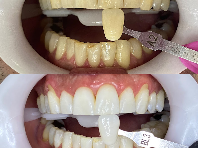 Foto 3 de Especialista em Periodontia em Hortolândia - Dra. Raíssa Agnelo Safra
