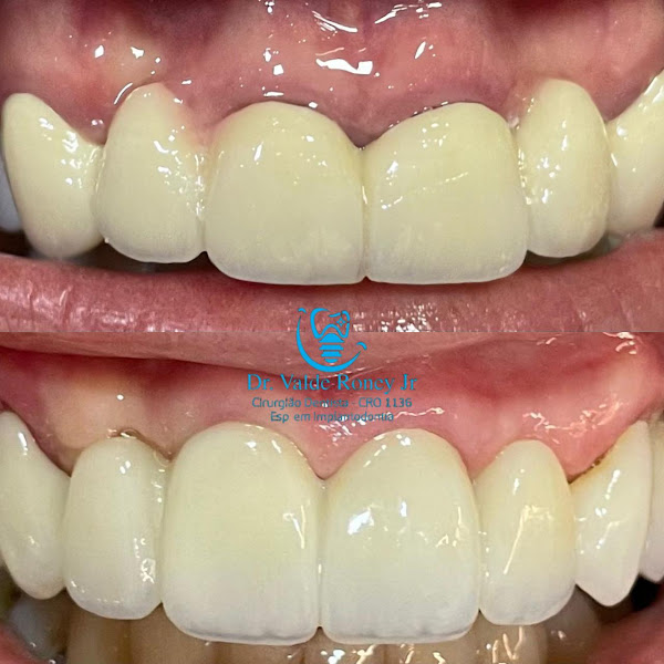Foto 3 de Essence Implant & Face
