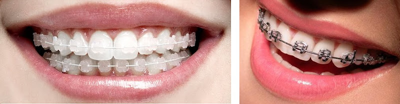 Foto 3 de Essence Odonto - Centro Odontológico