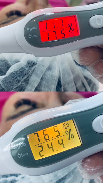Foto 3 de Essência Estética e bem-estar