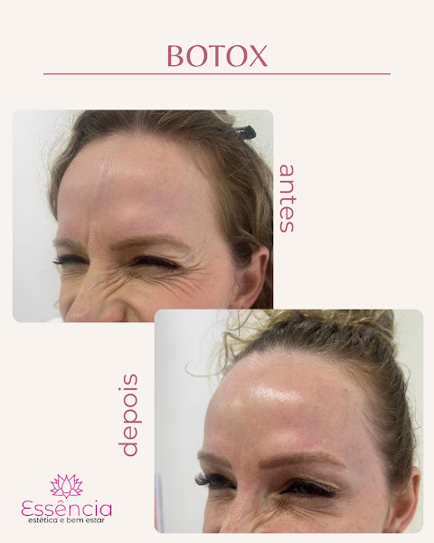 Foto 2 de Essência Estética e Bem Estar