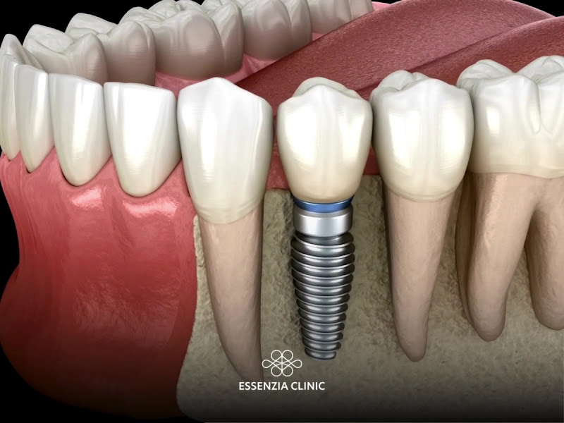 Foto 3 de Essenzia Clinic