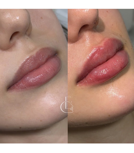Foto 3 de Esser Odontologia & Harmonização Facial