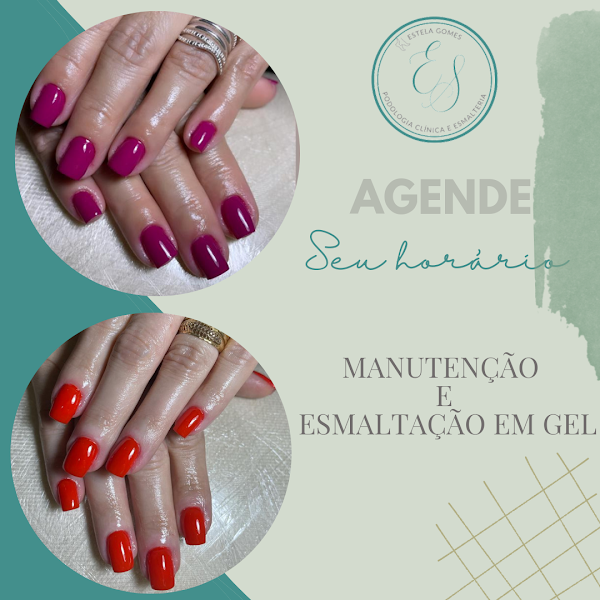 Foto 3 de Estela Gomes - Podologia clínica