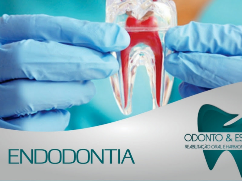 Foto 4 de ESTETIC DENTES