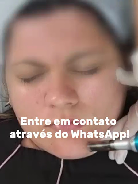 Foto 2 de Estetic Santé | Estética Facial e Corporal - Centro Metropolitano Barra