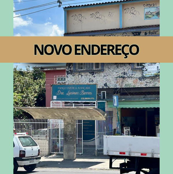 Foto 2 de Estética Avançada Dra Lacimar Barros Emagrecimento - Botox- Parque Anchieta RJ