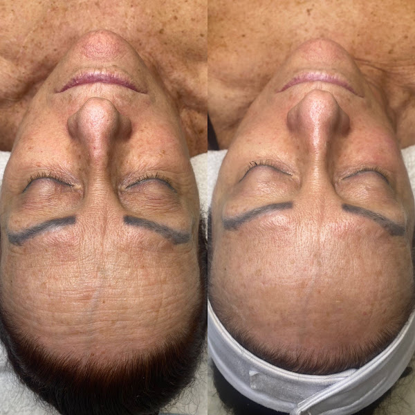 Foto 3 de Estética Avançada Dra. Marcilene Gois