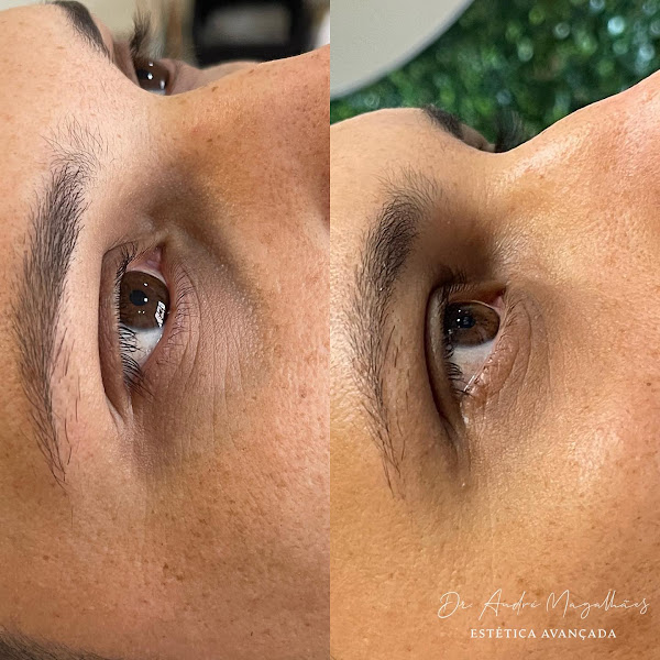 Foto 3 de Estética Avançada | Harmonização Facial | Dr. André Magalhães