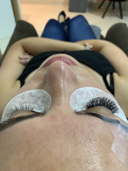 Foto 3 de Estética avançada- Iara Rafaela