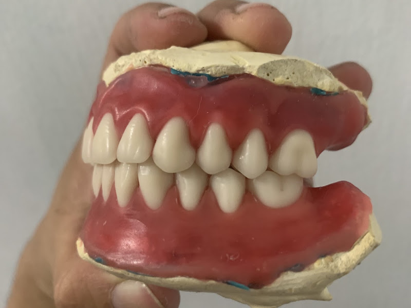 Foto 2 de Estética Bucal - Laboratório de Próteses Odontológicas