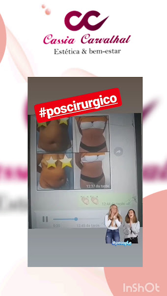 Foto 2 de Estética Cassia Carvalhal, tratamentos corporais e faciais.