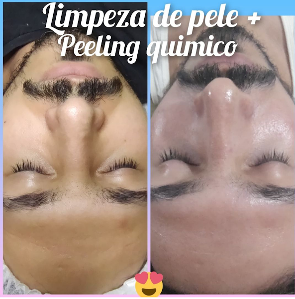 Foto 3 de Estética Corporal e Facial/Dhribellaestetica