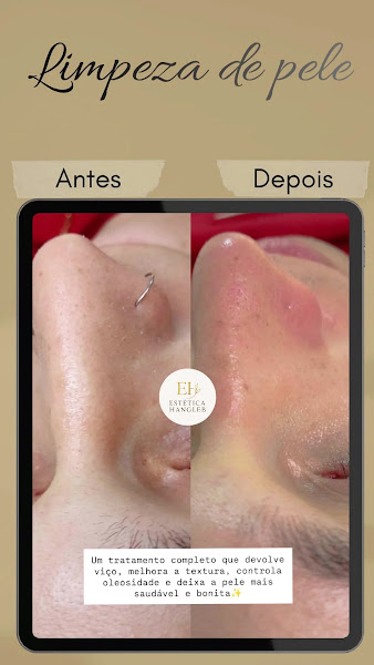 Foto 3 de Estética Hangleb