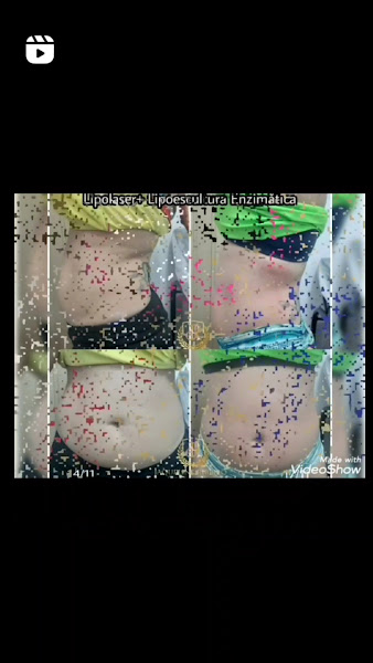 Foto 2 de Estética Jaqueline Ribeiro