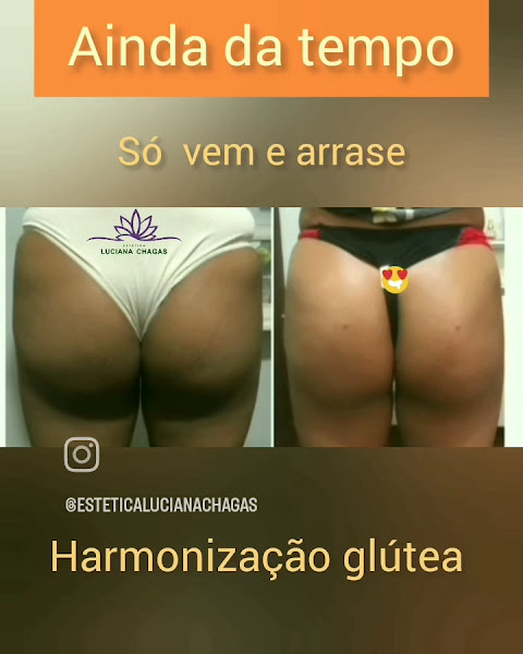 Foto 2 de Estética Luciana Chagas