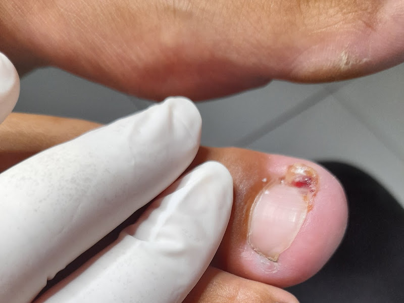 Foto 3 de Estética & Podologia Isabella Santos - Teixeira de Freitas – Bahia